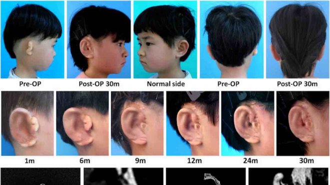 https://assets.roar.media/Bangla-News/2018/02/Lab-Grown-Ears-EBioMedicine.jpg